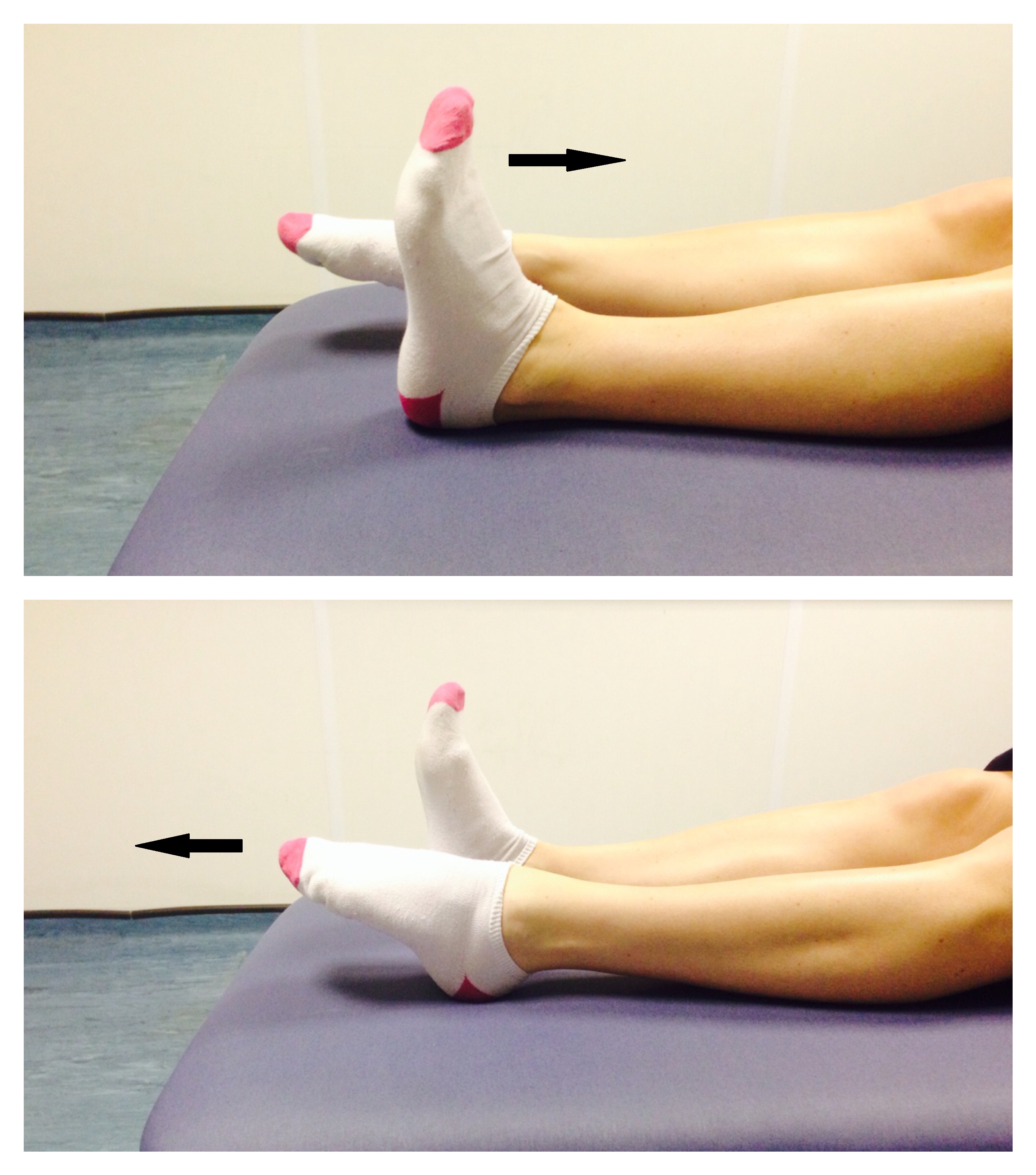 Recovery time for hotsell broken knee cap